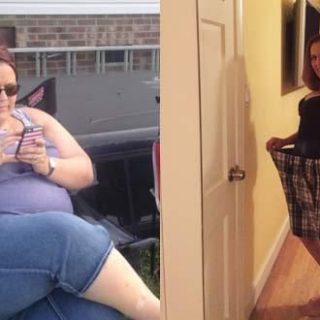 Weight Loss Success - Before and After with Cheryl P.