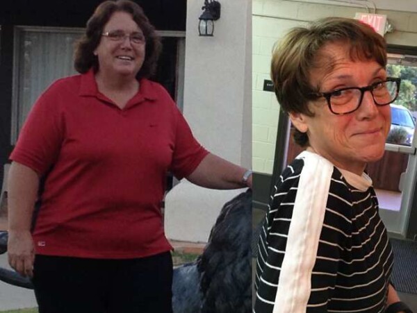 Judy M. Loses 108 Pounds Following Weight Watchers