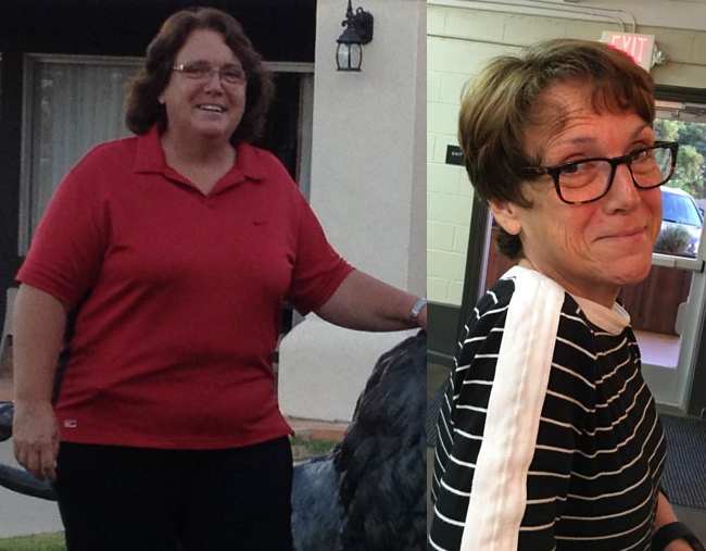 Judy M. Loses 108 Pounds Following Weight Watchers
