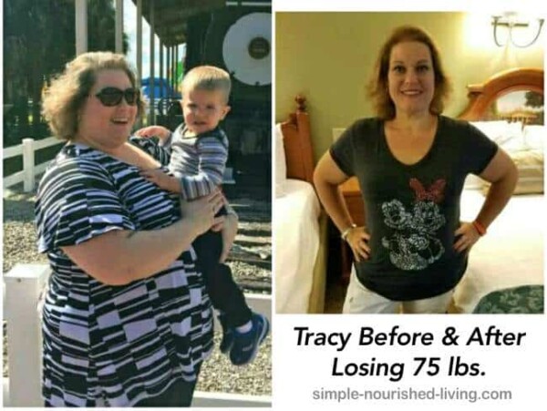 Tracy and her weight loss journey