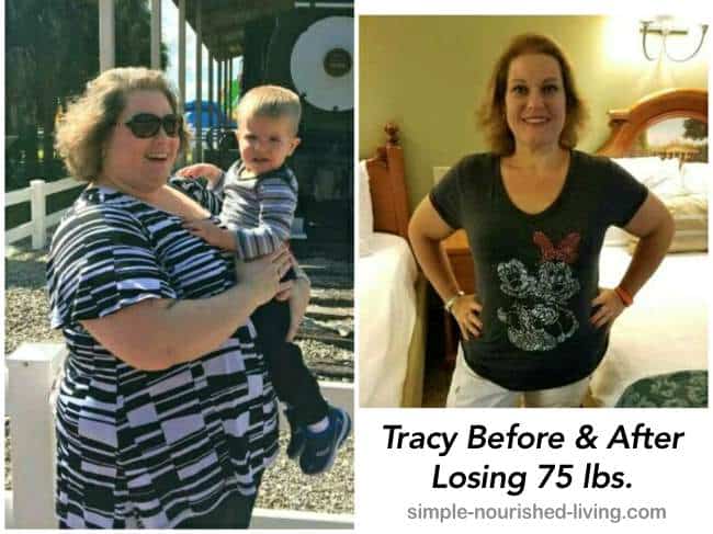 Tracy and her weight loss journey