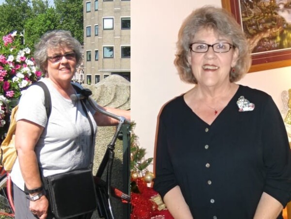 Barbara G. Before and After Weight Watchers Weight Loss Success Journey