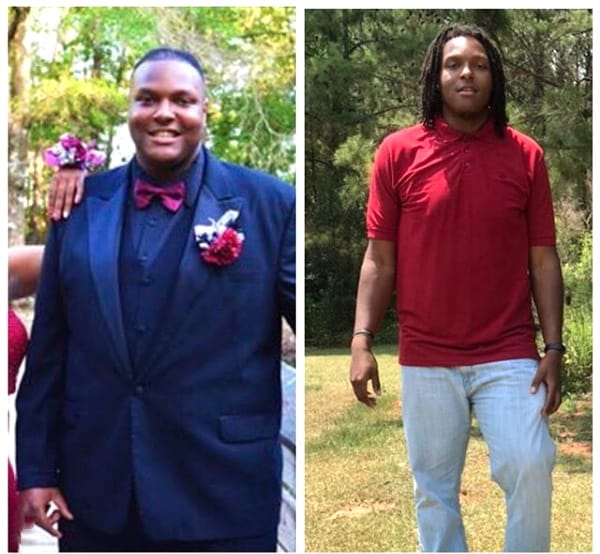 Keyshawn G. Before and After weight loss