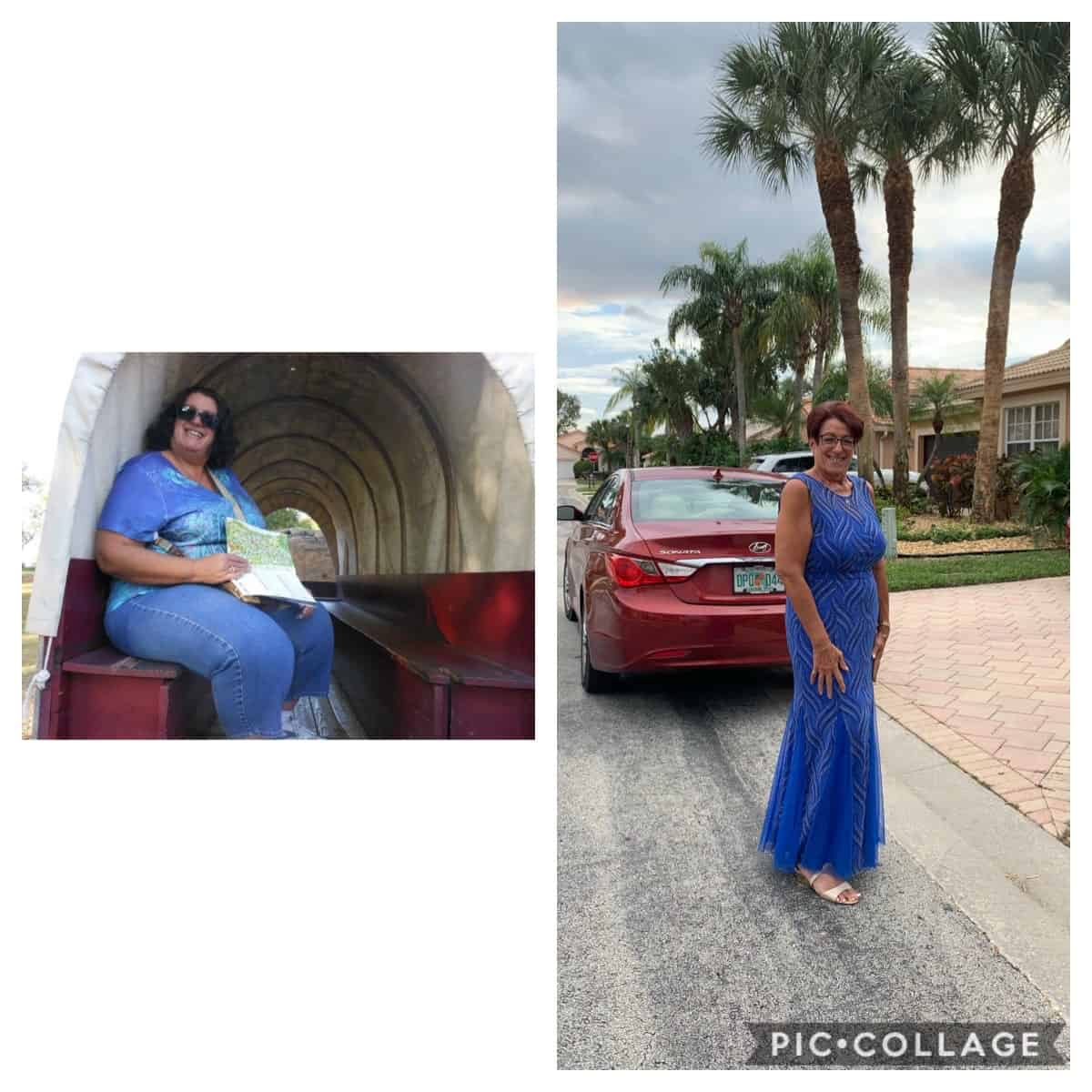 Bonnie before and after weight loss journey - over 100 pounds lost!