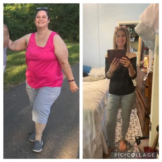 Dana H. before and after weight loss success - 130 pounds lost.