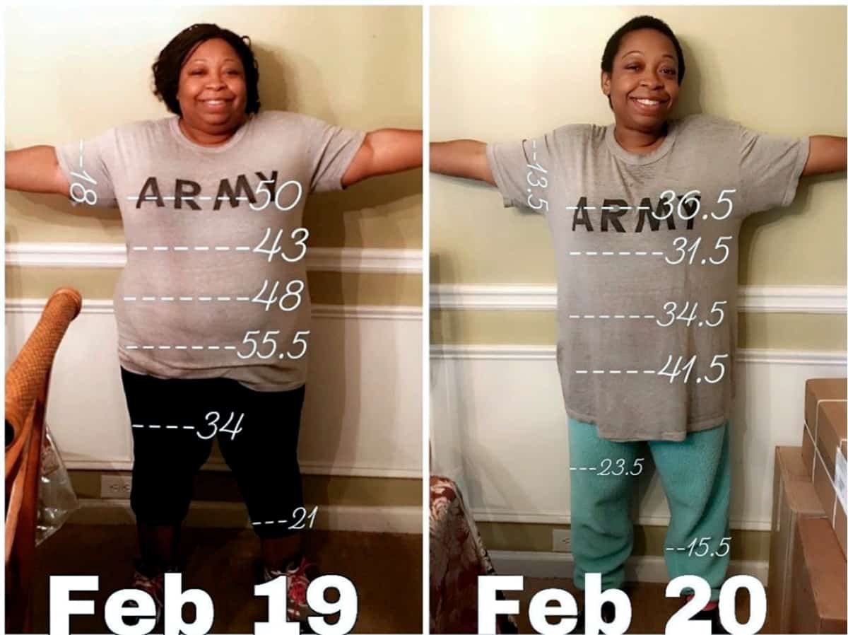 Nancy's before and after weight loss success.