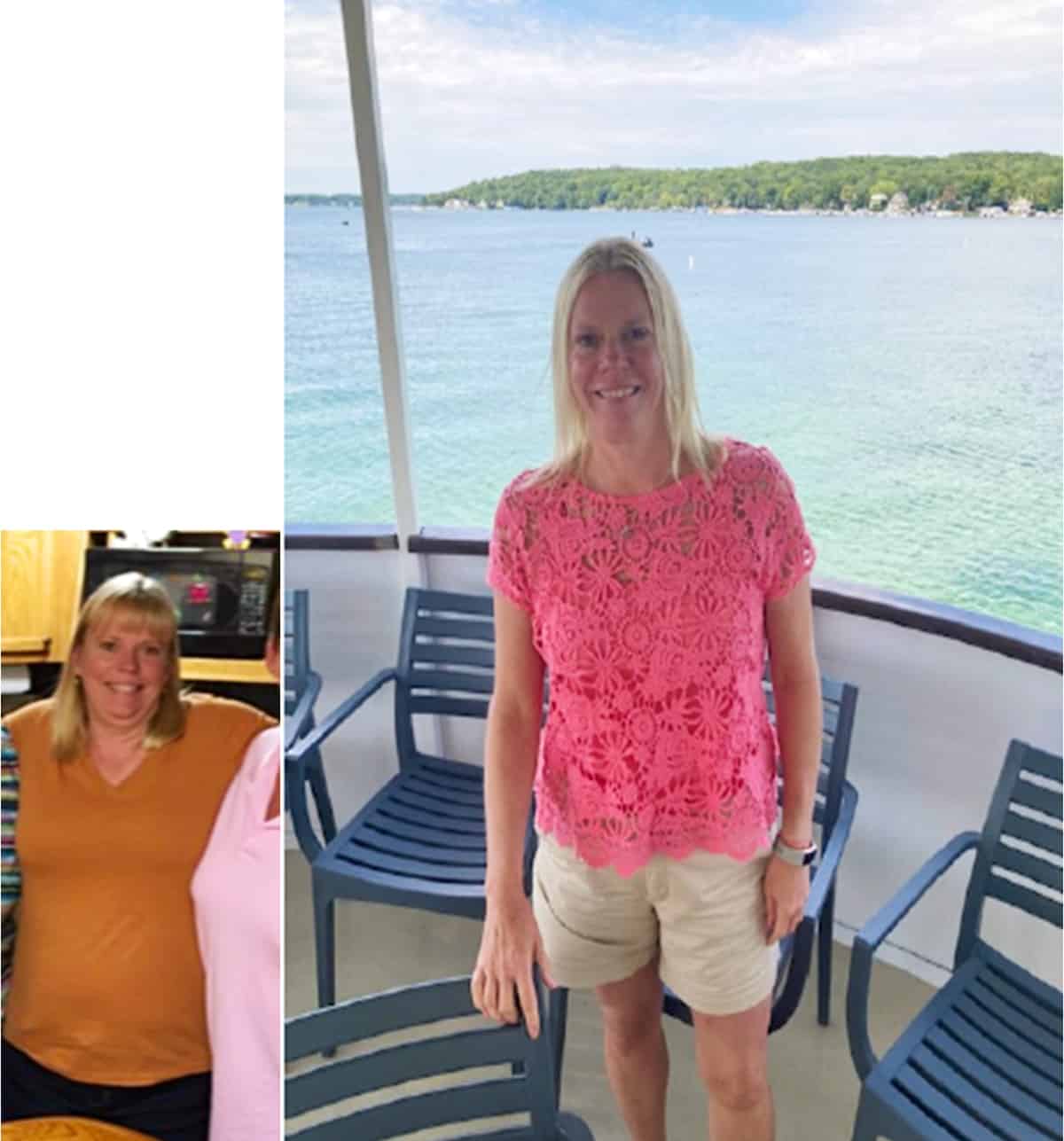 Gail B. before and after weight loss.