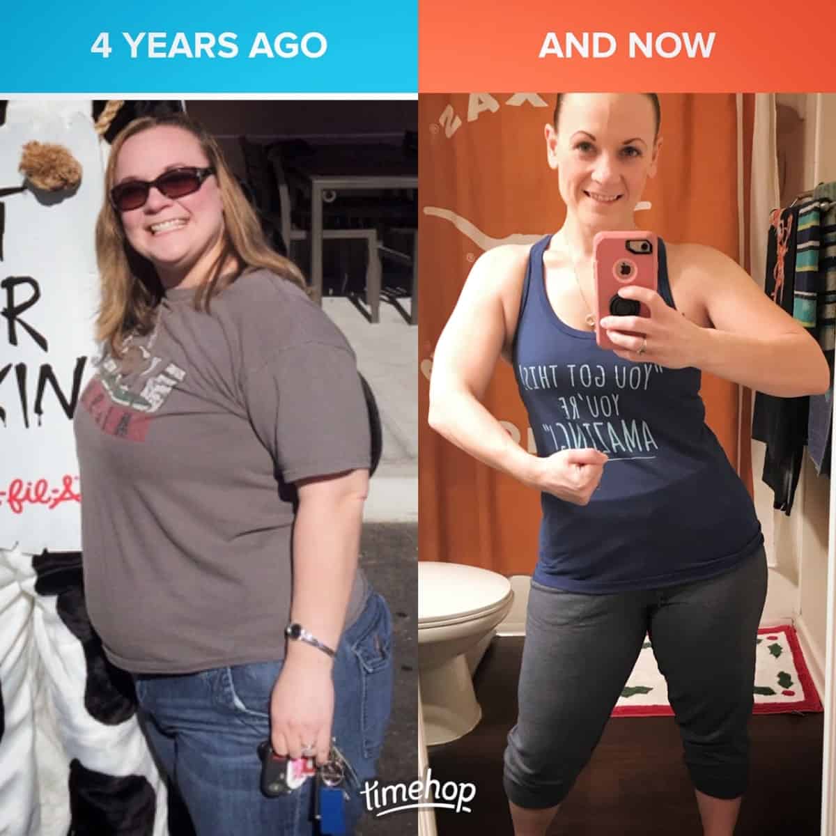 Hope B. before and after weight loss comparison.
