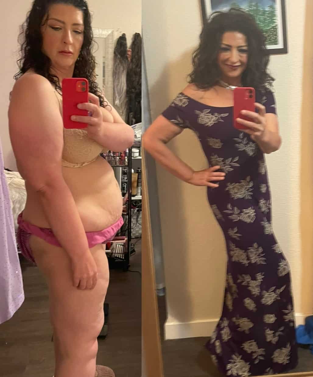 Lora L. before and after 125 pound weight loss.